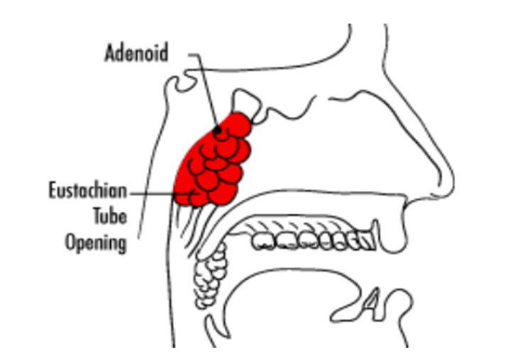 Adenoidi e Tonsille PROF. FABRIZIO SALVINELLI
